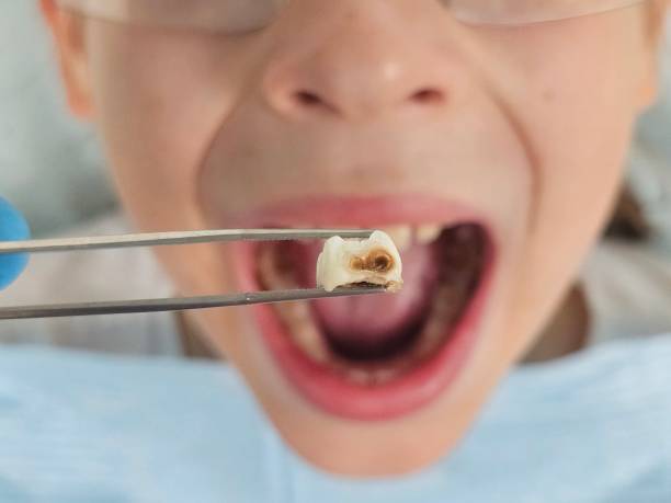 Best Walk-In Emergency Dental Services in Coloma, MI